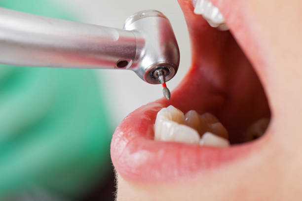 Best Cracked Tooth Emergency Dentist  in Newport, RI